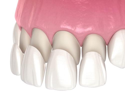 Cosmetic Dentistry